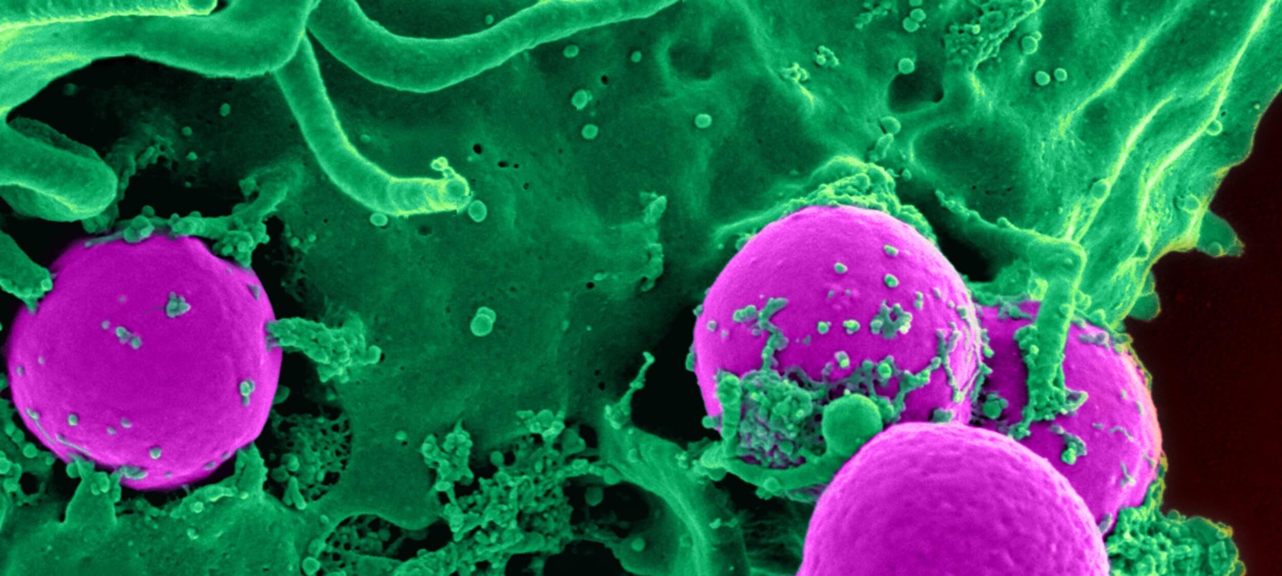 Communicable Puzzles: Children’s Most Common Infectious Diseases